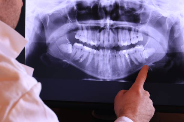 Best Urgent Care for Lost Fillings or Crowns in Duluth, WA